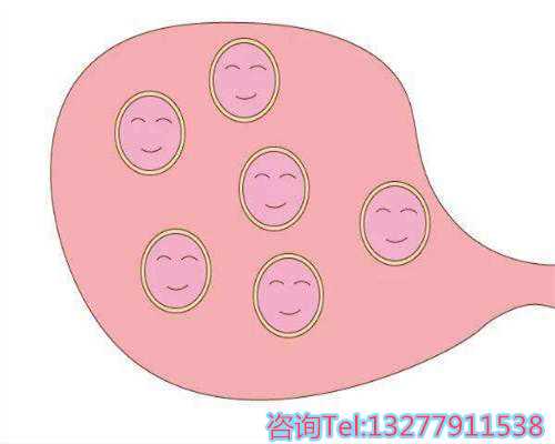 单身女性前往上海做试管婴儿要准备多少钱